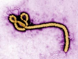 Colorized transmission electron micrograph (TEM) revealing some of the ultrastructural morphology displayed by an Ebola virus virion. Photo credit: Frederick A. Murphy